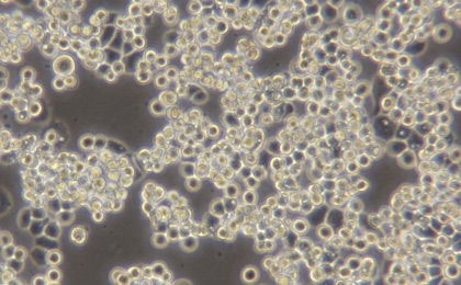 人乳腺癌细胞MDA-MB-453(STR鉴定正确)